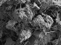 Fungal hyphae - soil aggregates