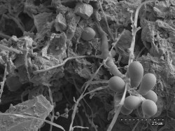 Fungal spores budding from hyphae