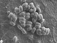 A photograph of a bacterial